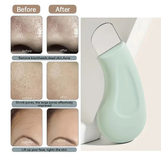 Silicone Facial Blackhead Removal